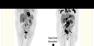 William Makis MD: Unveiling Medical Censorship Amidst “Turbo Cancer” Possibility