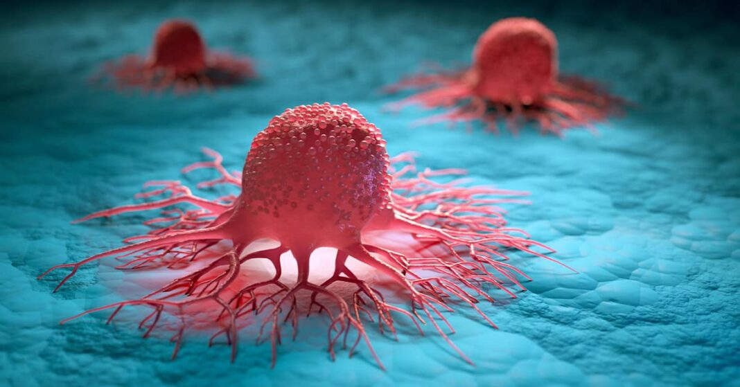 Cancer: The misunderstood disease of success Cancer: The misunderstood disease of success